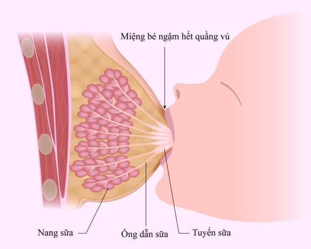 Mẹ sau sinh hay bị tắc tia sữa phải làm sao