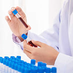 Lưu trữ máu cuống rốn