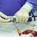 Lưu trữ màng dây rốn