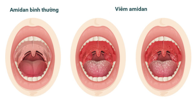 benh vien kham tai mui hong uy tin 2 e1690362527973