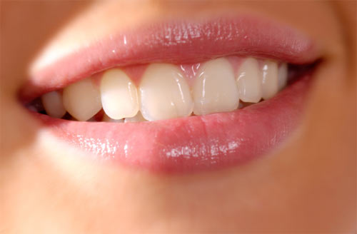 Niềng răng 3D cho nụ cười tự tin, tỏa sáng