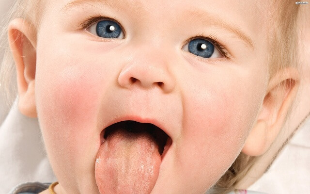 Các bệnh về lưỡi ở trẻ em phổ biến nhất, mẹ có biết?