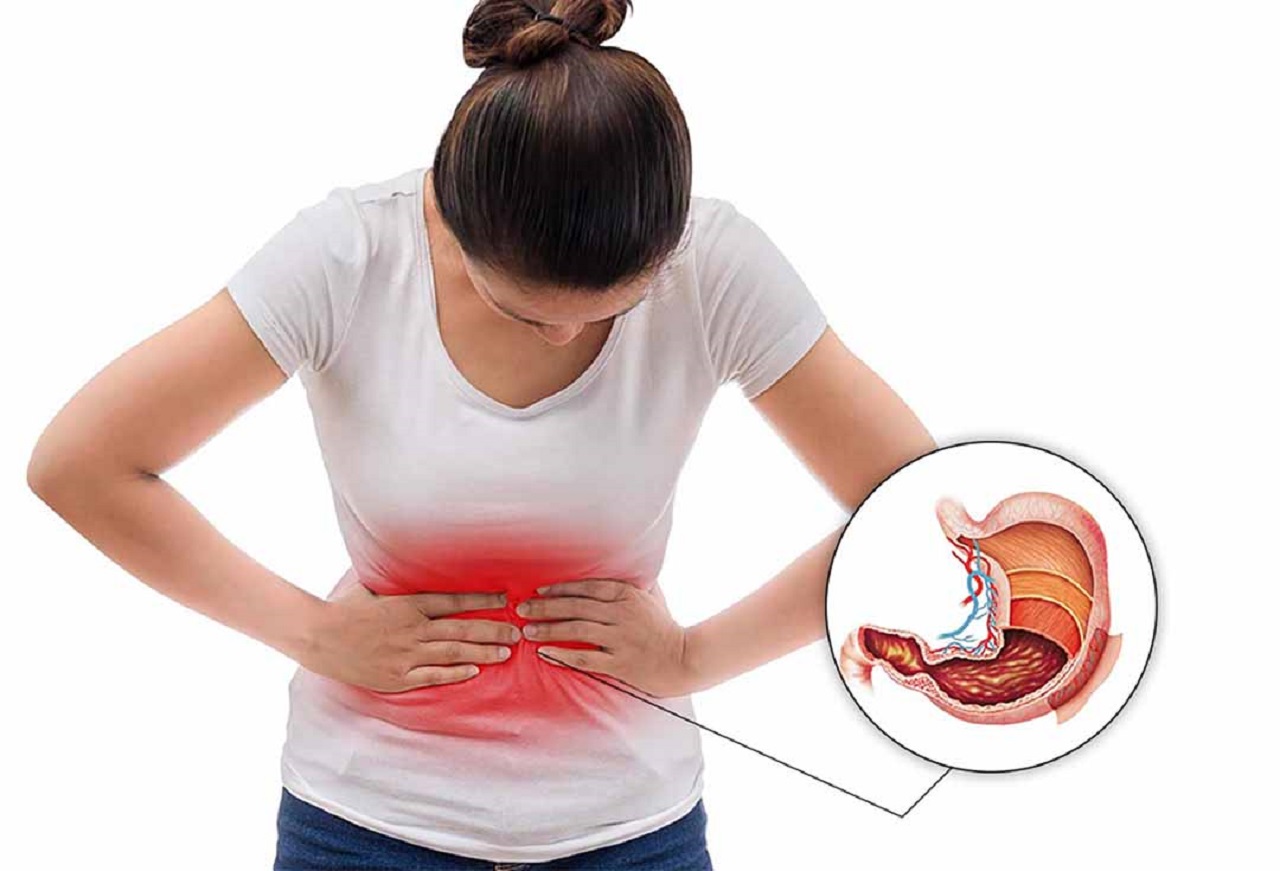Liệu việc đau bụng trên rốn sau khi ăn có thể chỉ là triệu chứng của một căn bệnh tiêu chảy?
