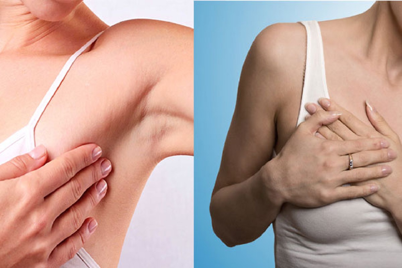 Cách nhận biết và điều trị đau ngực 2 bên nách và tác dụng của chúng