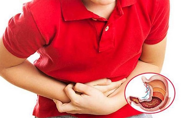 viêm dạ dày gây đau bụng