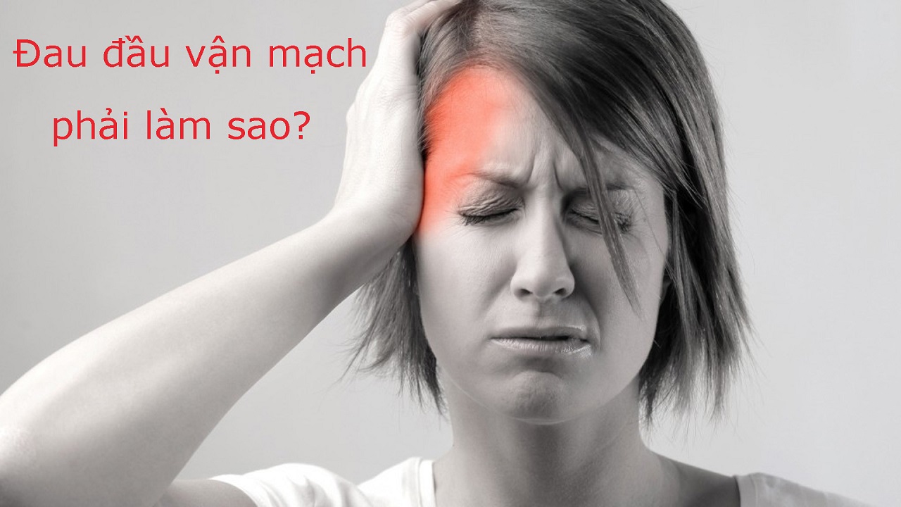 Bệnh đau đầu vận mạch là gì?
