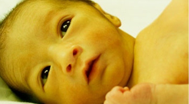 Thông tin về dấu hiệu bệnh gan ở trẻ sơ sinh phải biết để bảo vệ sức khỏe bé yêu