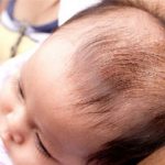 Bệnh nấm da đầu ở trẻ em và những lưu ý quan trọng