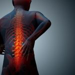 Chữa đau lưng do loãng xương mật độ xương thấp