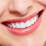 Bọc răng khoa Răng hàm mặt – bệnh viện Thu Cúc