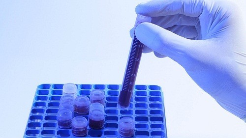Xét nghiệm estradiol là xét nghiệm được sử dụng để đo nồng độ estradiol trong máu.