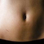 Cắt tử cung có ảnh hưởng gì?sức khỏe và chất lượng cuộc sống