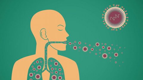 6 Di chứng của bệnh lao phổi bạn không nên chủ quan