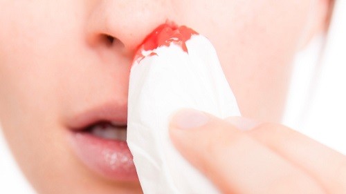 Chảy máu mũi thường xảy ra ở độ tuổi nào?
