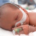 Suy hô hấp ở trẻ sinh non tính mạng của trẻ