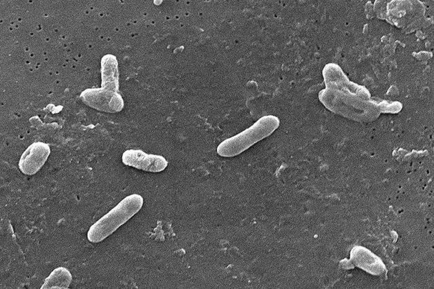 Nguyên nhân phát sinh ho gà là trực khuẩn gram âm Bordetella. pertussis