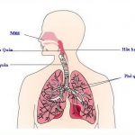 Biểu hiện của viêm đường hô hấp trên ở trẻ