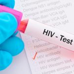 Xét nghiệm HIV ở đâu? có nguy cơ tử vong cao
