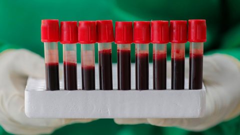 Xét nghiệm nhóm máu thực hiện thế nào và đặc điểm