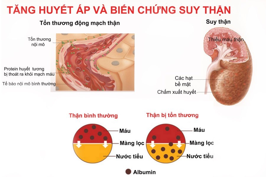 Kết luận và lời khuyên từ chuyên gia