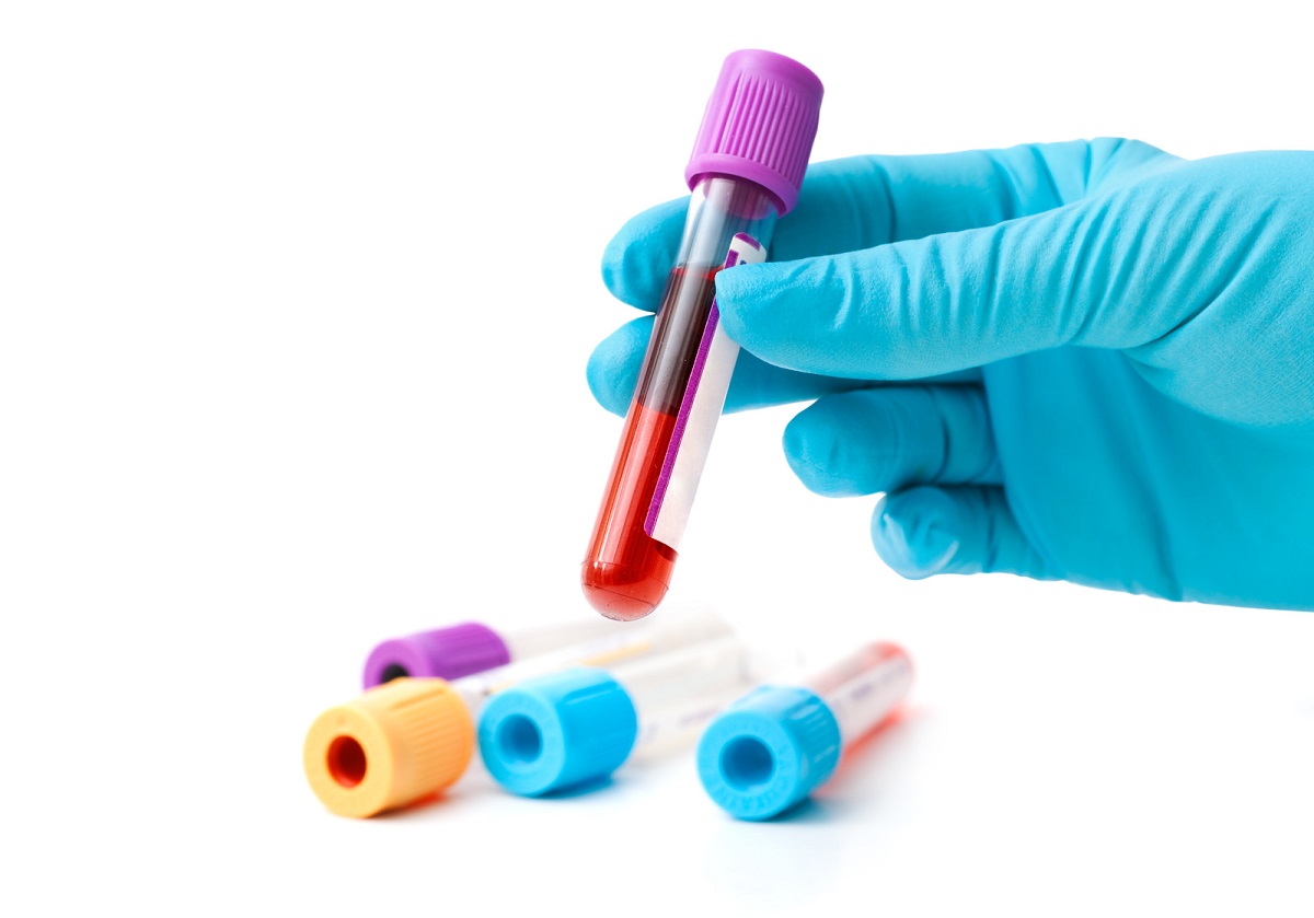 Giá trị bình thường của HGB trong xét nghiệm máu là bao nhiêu?  
