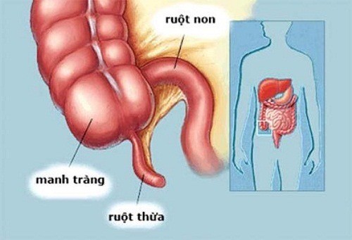 Ruột thừa là gì? Ruột thừa có tác dụng gì?