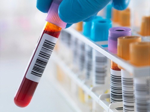 Anti HCV âm tính là gì, những điều cần lưu ý
