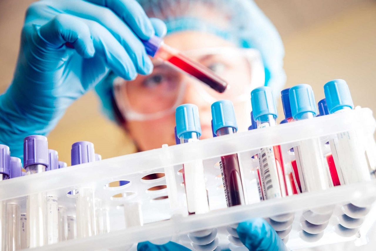 Cùng tìm hiểu test hcv là gì và cách phòng chống bệnh viêm gan C