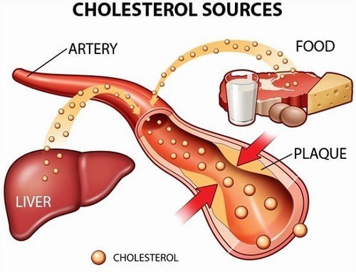 Hậu quả của mức cholesterol cao đối với sức khỏe?