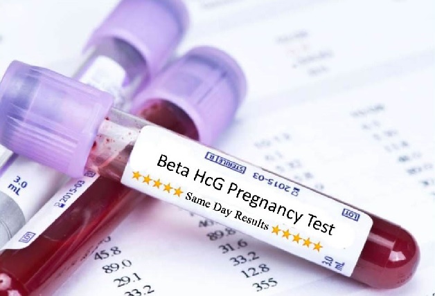 Nguyên nhân beta hCG thấp là điều được nhiều mẹ bầu quan tâm