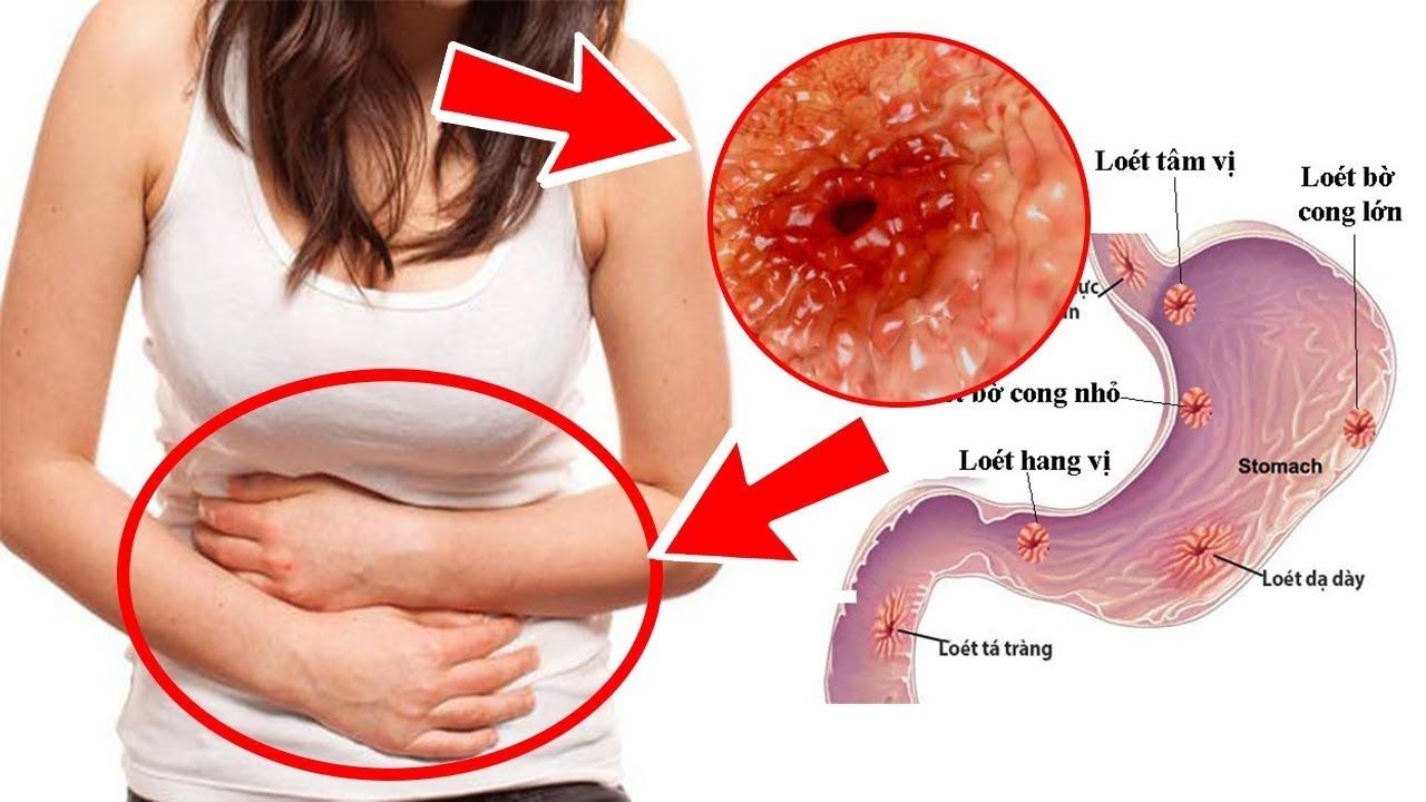 Dạ dày nằm gần những cơ quan nào trong ổ bụng?
