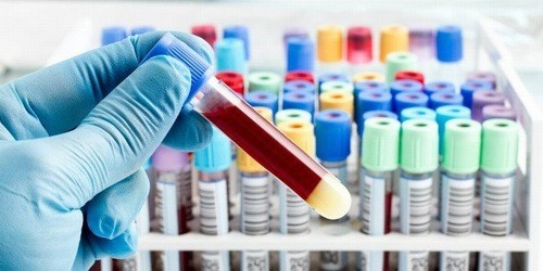 Xét nghiệm máu cần thiết trong chẩn đoán và điều trị bệnh lý