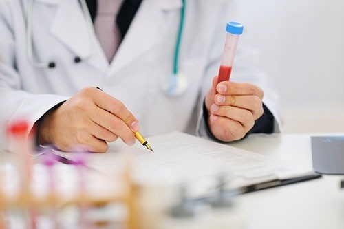 Xét nghiệm chlamydia dương tính cảnh báo bệnh lậu