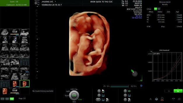 Hình ảnh siêu âm thai đôi sẽ mang lại cho bạn một trải nghiệm thú vị và đáng nhớ khi bạn được chiêm ngưỡng sự phát triển đầy kì diệu của hai em bé cùng một lúc.