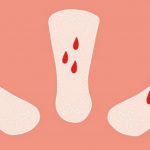 Ra máu trước kỳ kinh nguyệt: Nguyên nhân và cách xử trí