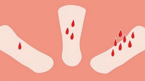 Ra máu trước kỳ kinh nguyệt: Nguyên nhân và cách xử trí