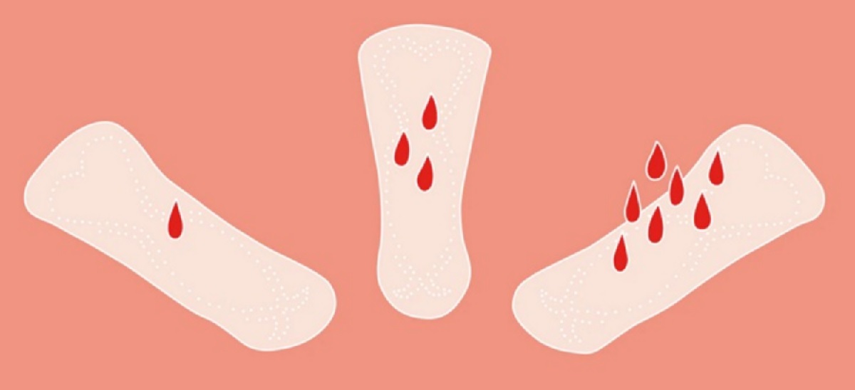 Những nguyên nhân gây ra máu nâu trước kỳ kinh là gì?
