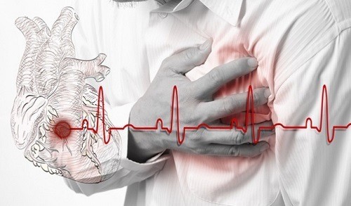 Tim đập nhanh có thể do nhiều nguyên nhân gây ra.