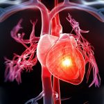 Đau tim là bệnh gì? xuất phát từ nhiều nguyên nhân khác nhau