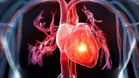 Đau tim là bệnh gì? xuất phát từ nhiều nguyên nhân khác nhau