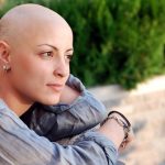 Vì sao hóa trị ung thư lại rụng tóc?