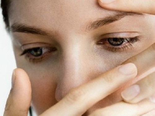 Viêm bờ mi thường được chia làm 2 nhóm: viêm bờ mi trước và viêm bờ mi sau.