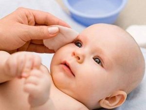 Viêm bờ mi là một bệnh lý mạn tính, khó điều trị dứt điểm.