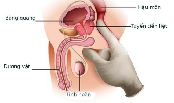 KHÁM VÀ ĐIỀU TRỊ VIÊM NIỆU ĐẠO Ở NỮ GIỚI | TCI Hospital