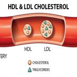 Chỉ số LDL cholesterol là gì?làm tăng nguy cơ mắc bệnh tim mạch