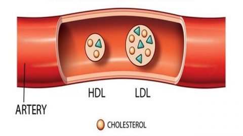 Chỉ số LDL cholesterol là gì?làm tăng nguy cơ mắc bệnh tim mạch