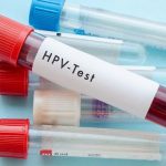 Giải đáp thắc mắc: HPV dương tính phải làm sao?