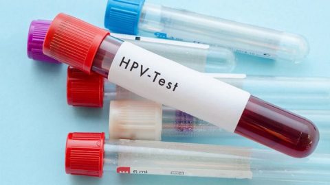Giải đáp thắc mắc: HPV dương tính phải làm sao?