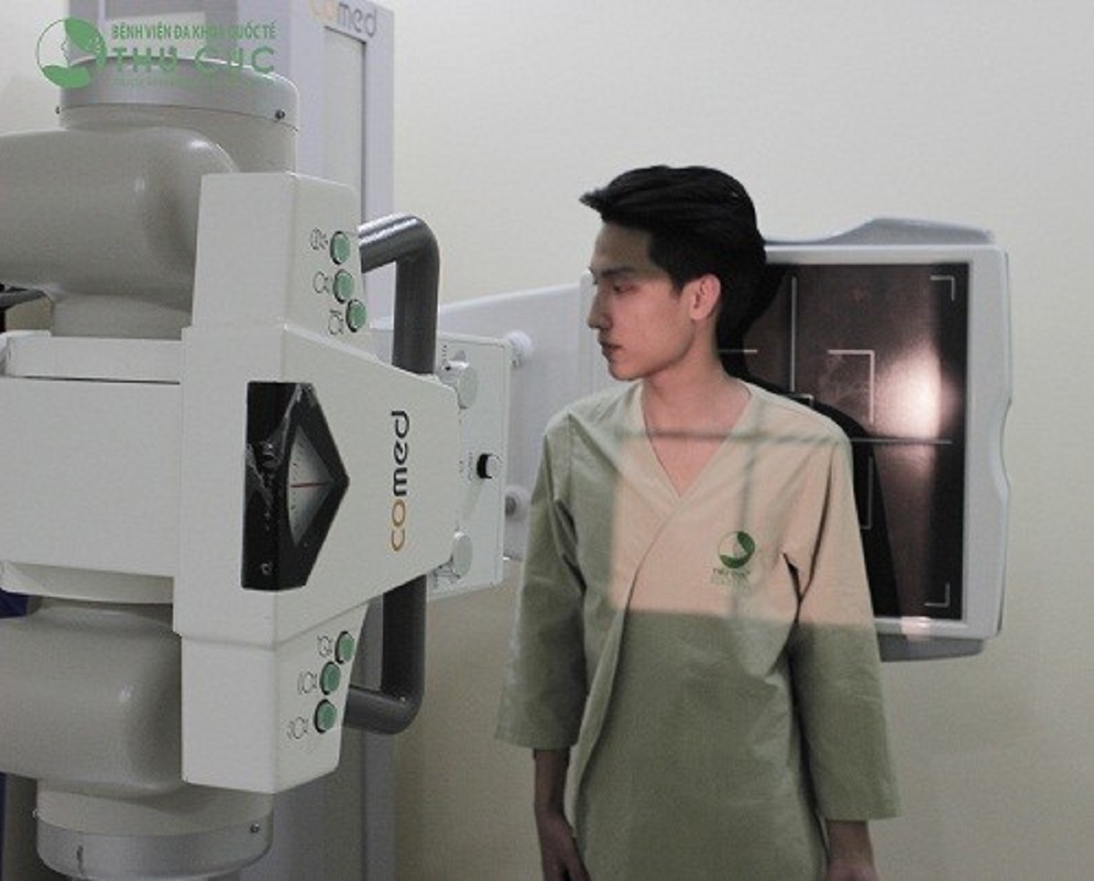 Quần áo có cần tháo để chụp X quang phổi?
