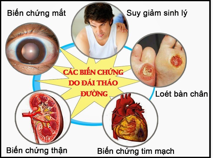 Các biến chứng nguy hiểm của bệnh đái tháo đường